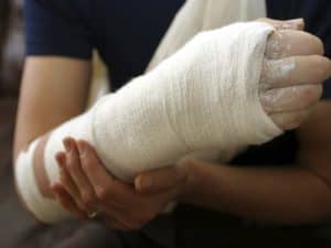 person's arm in cast from crush injury